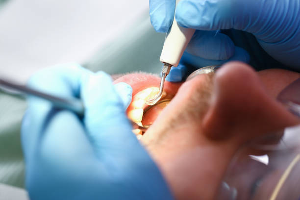 Best Pediatric Emergency Dentist in Long Beach, CA