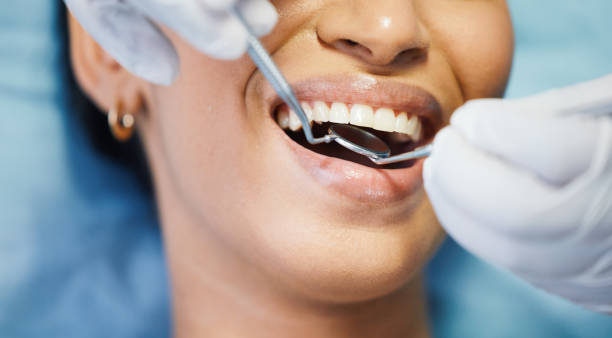 Best Emergency Treatment for Dental Infections or Abscesses in Long Beach, CA