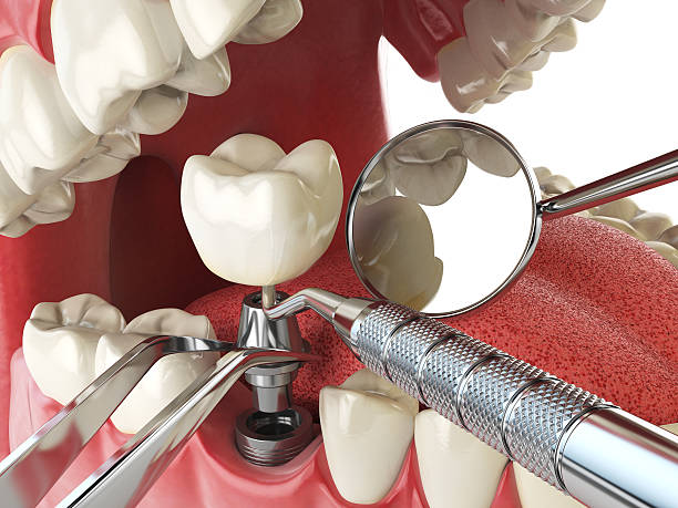 Best Weekend Emergency Dentist in Long Beach, CA