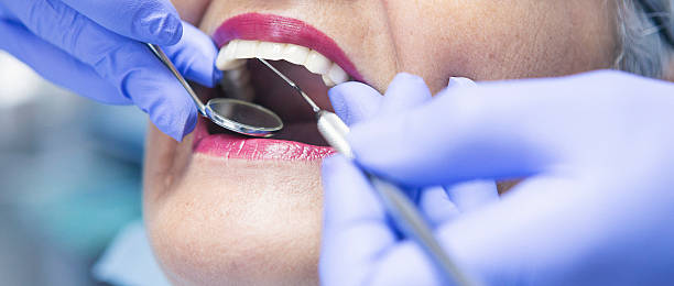 Best Urgent Care for Lost Fillings or Crowns in Long Beach, CA